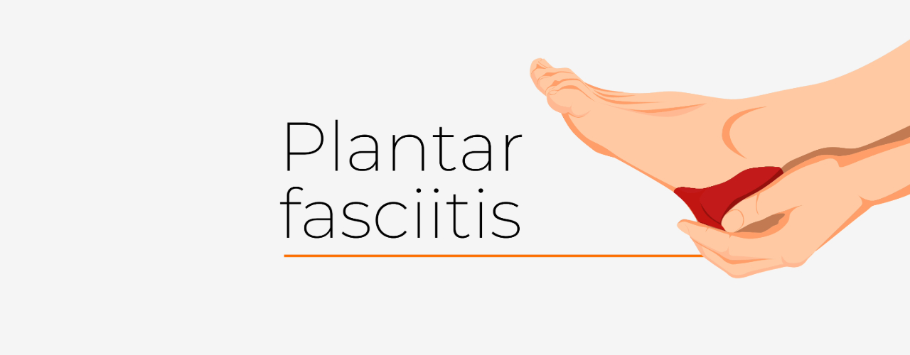 Plantar Fasciitis